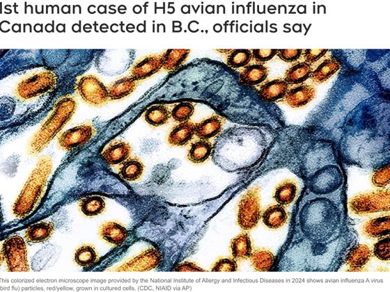 紧急警报！加拿大报道首例人类感染H5禽流感病例